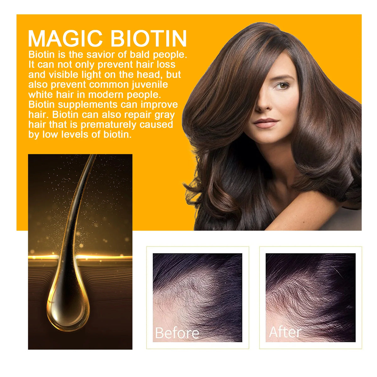 EELHOE Biotin Hair Spray For Man Women 30ml Hair Growth Repair Damage Restore Oil Scalp Repair Serum Spray Thicken Hair Care