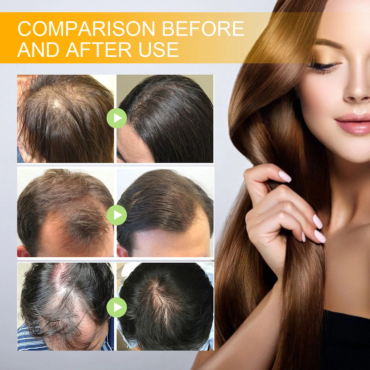EELHOE Biotin Hair Spray For Man Women 30ml Hair Growth Repair Damage Restore Oil Scalp Repair Serum Spray Thicken Hair Care